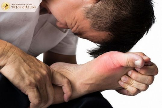 Nguyên nhân và yếu tố kích hoạt cơn gout cấp