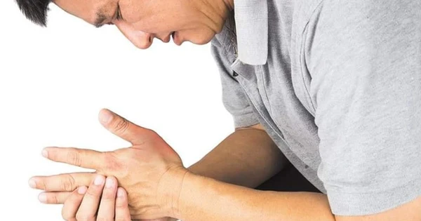 Đau khớp đột ngột và dữ dội là triệu chứng của cơn gout cấp