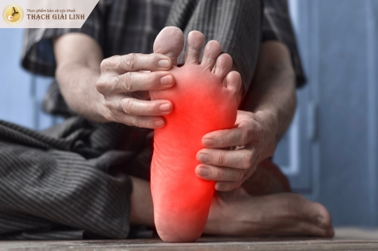 Tê bì và cảm giác châm chích là triệu chứng gout bàn chân
