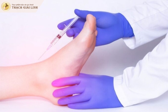Chọc hút dịch khớp xác định lượng tinh thể urat