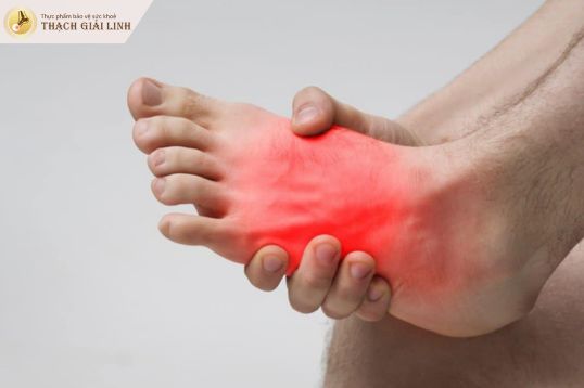 Đau mu bàn chân có phải gout không? Khi nào cần đi khám?