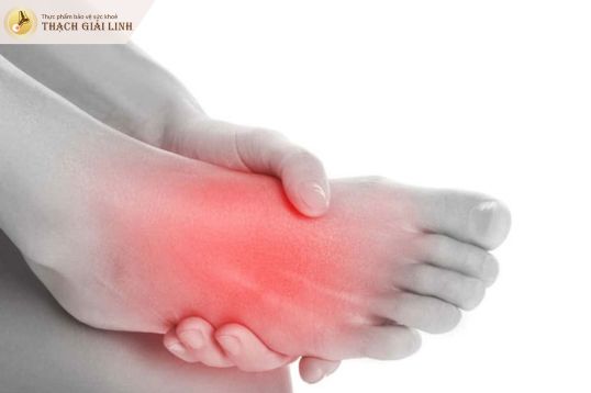 Cơn đau gout ở mu bàn chân thường đột ngột và dữ dội