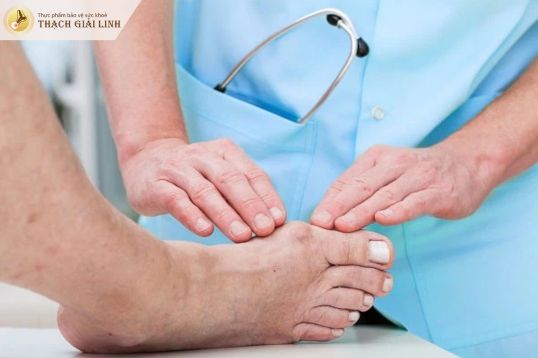 Các triệu chứng gout ở ngón chân cái cần thăm khám ngay