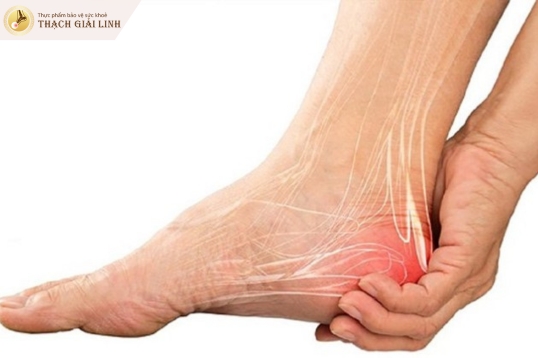 Triệu chứng gout ở gót chân: Đừng chủ quan với cơn đau đột ngột!