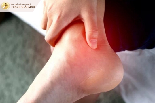 Gout có thể gây đau gót chân không?