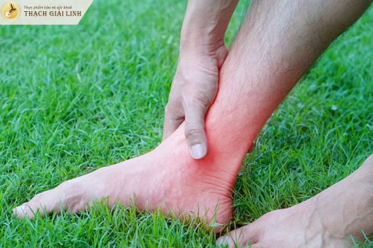Bệnh giả gout là gì?