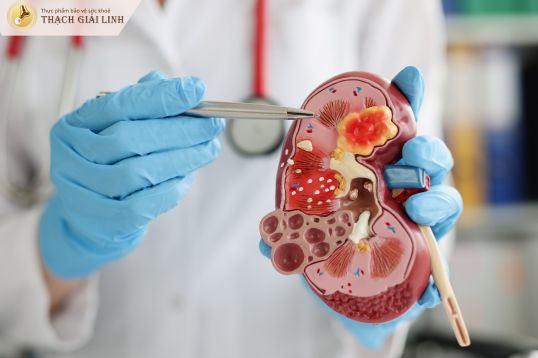 Chức năng thận suy giảm làm tăng lượng acid uric tích tụ trong cơ thể