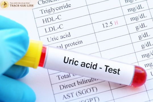 Xét nghiệm máu đo nồng độ acid uric