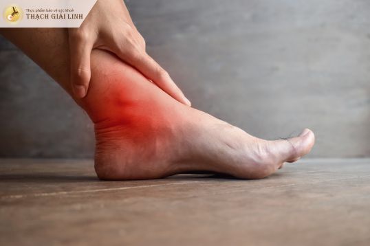 Đau cổ chân do gout: 4 Dấu hiệu chẩn đoán bệnh chính xác
