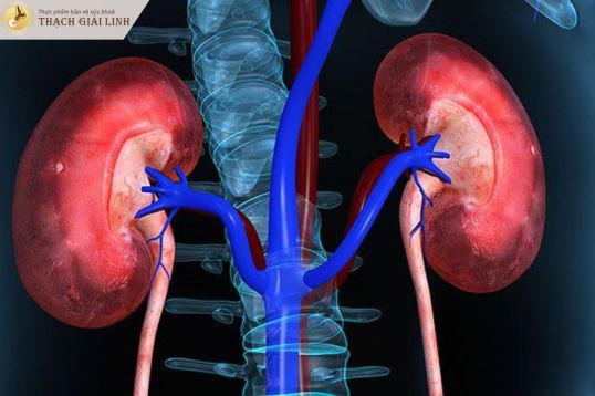 Suy thận là một trong những biến chứng của bệnh gout