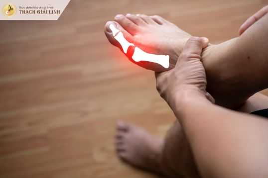 Dấu hiệu bệnh gout ở ngón chân