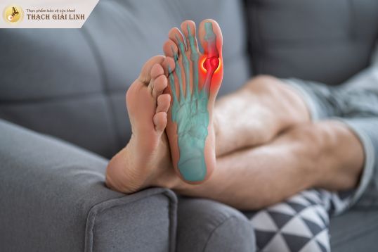 Tại sao ngón chân dễ bị gout?