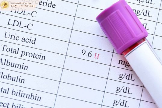 Acid uric trong máu tăng cao kéo dài nên siêu âm chẩn đoán gout