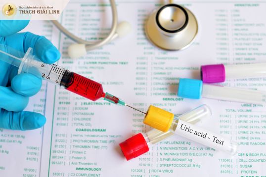 Cơ chế hình thành gout tại khớp cổ tay