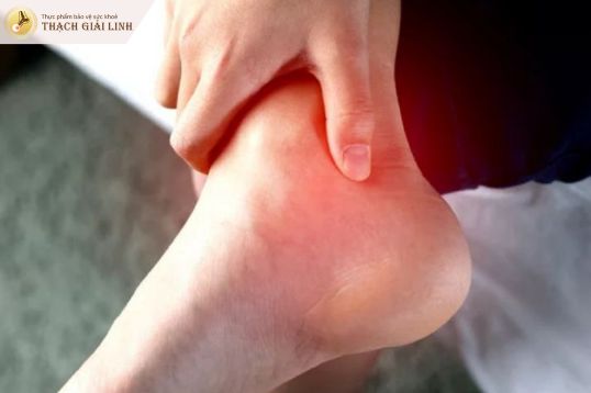 Gout sưng mắt cá chân có nguy hiểm không?