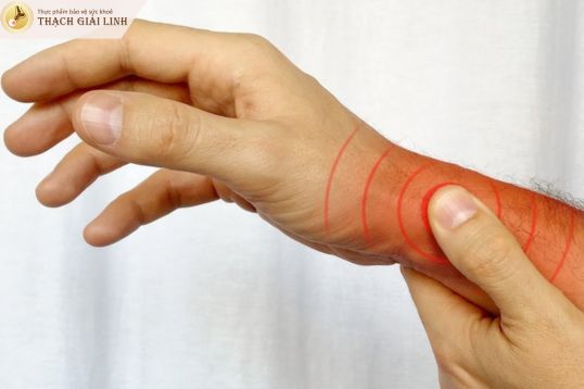 Khớp cứng và khó vận động là triệu chứng giả gout thường gặp