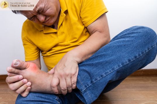 Gout ở nam giới thường có các đợt viêm cấp bùng phát mạnh