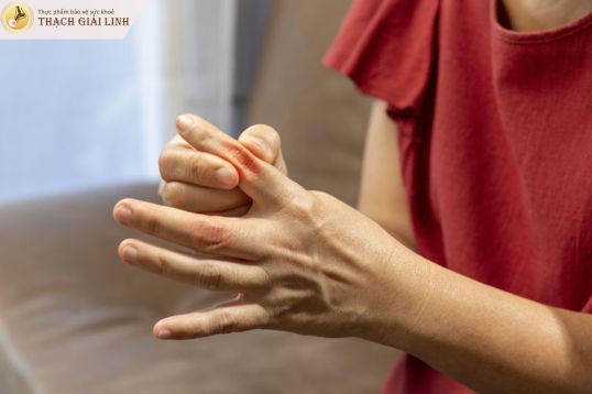 Nhận biết nhanh 3+ triệu chứng gout ở nữ