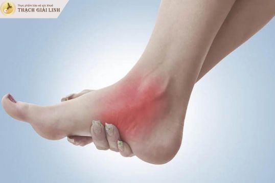 Gout có xảy ra ở nữ giới không?