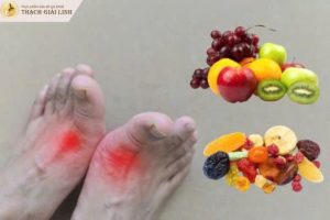 Bệnh gút không nên ăn quả gì?