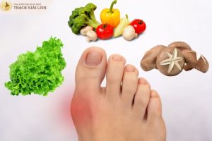 Bị gout không nên ăn rau gì?