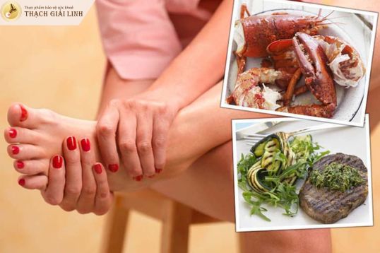 Người bị gout không nên ăn gì?