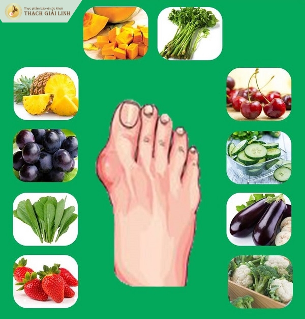 Kiểm soát thực đơn ngăn ngừa gout tái phát hiệu quả
