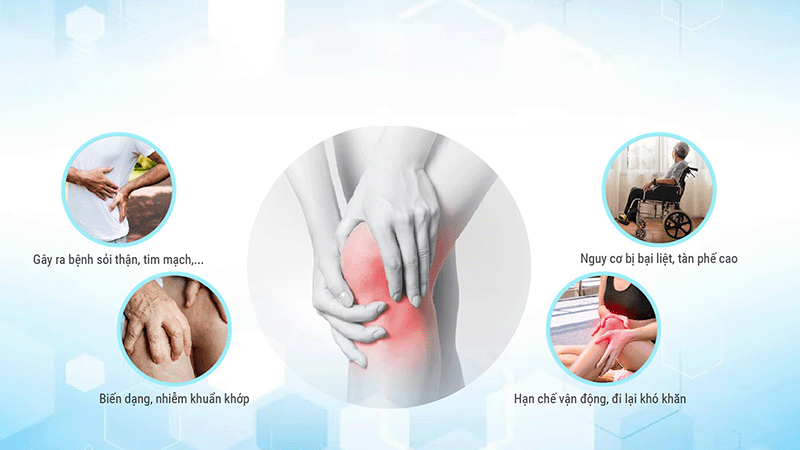 Viên Gout Thạch Giải Linh hỗ trợ hiệu quả trong việc điều trị bệnh gout